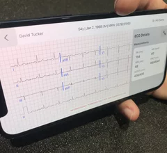 Remote ECG access on a smart phone via the Viz.ai Cardio Suite, which enables access to dynamic ECG, echo, MRI, CT images and reports. It also enables automated detection on imaging to alert care teams for STEMI, hypertrophic cardiomyopathy, pulmonary embolism, aortic dissection and abdominal aortic aneurysm, and heart failure.