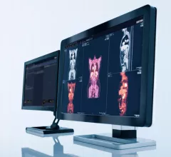 A radiologists reading station, image from Sectra