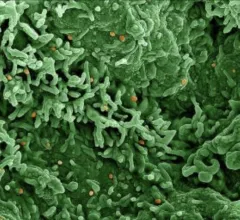 Colorized scanning electron micrograph of monkeypox virus (orange) on the surface of infected VERO E6 cells (green). Credit: NIAID