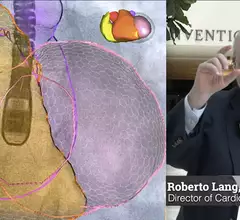 Roberto Lang, MD, explained the AI advances in echocardiography that will make it a requirement to have in the coming years at ASE 2023. #ASE #AIhealthcare #ASE2023