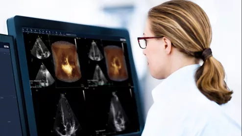 Cardiovascular information systems (CVIS) combine imaging and reporting into one system that allows access across the cardiovascular service line. Here are 7 trends in CVIS according to KLAS.