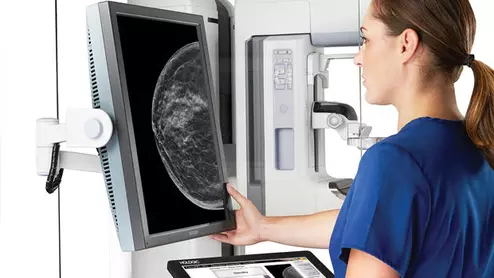 probably benign abnormalities on mammogram